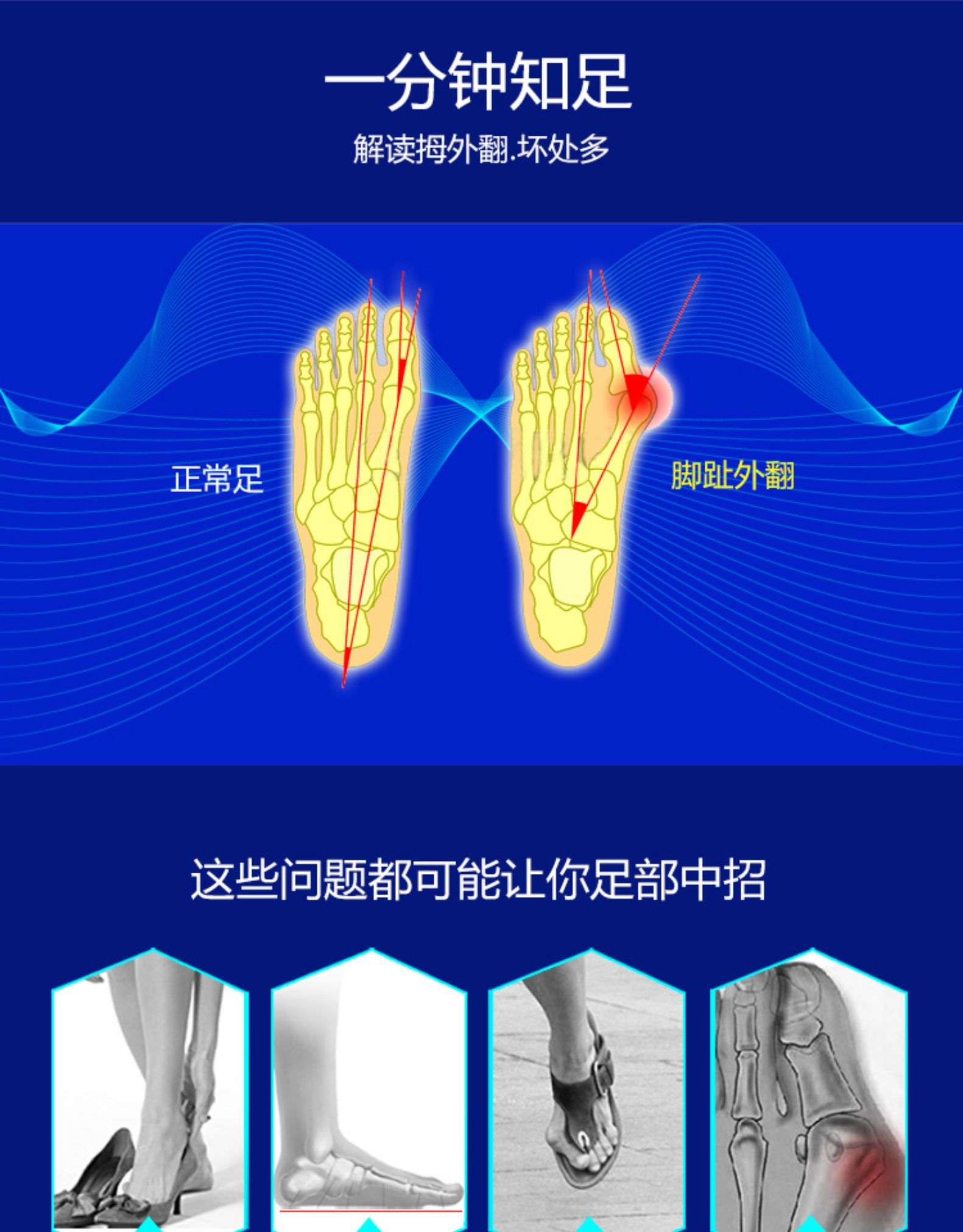 脚变形怎么矫正图解图片