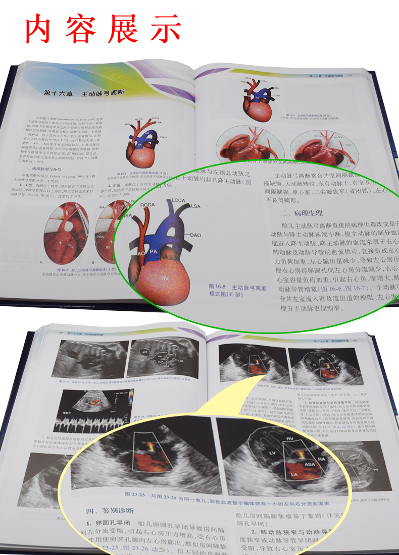 胎儿心脏畸形解剖与超声对比诊断 胎儿 超声 胎儿超声心动图 先天性