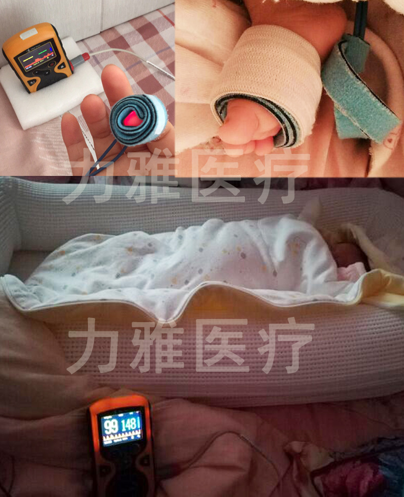 新生儿脉氧仪器图片