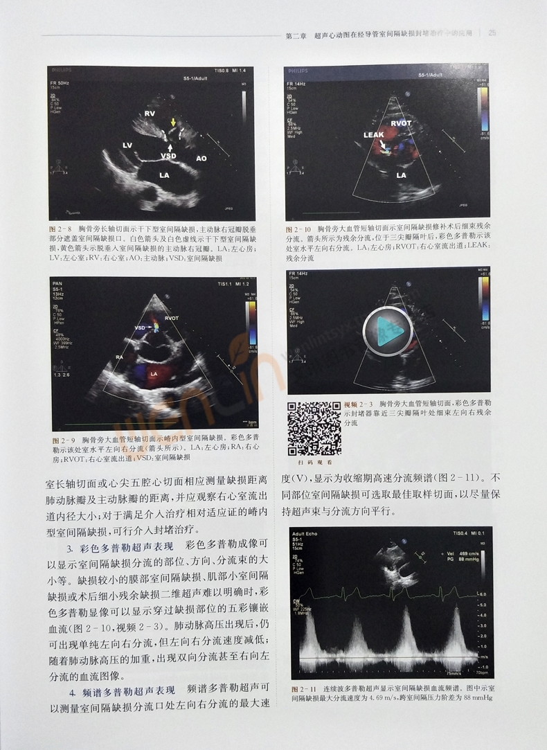 超声心动图在经导管心血管治疗中的应用 葛均波主编 上海科学技术出版