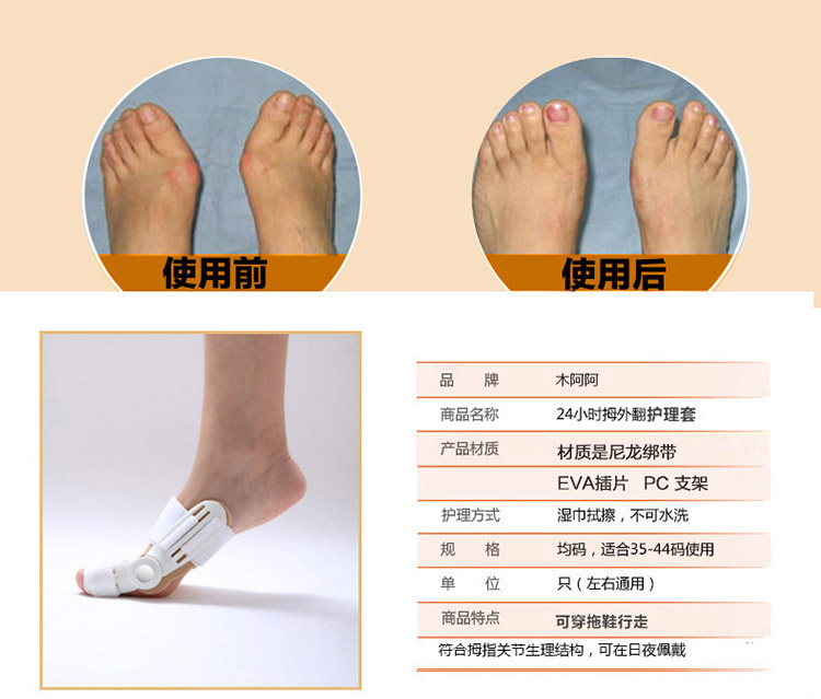
                                        木阿阿 24小时拇外翻矫正器日夜用 大脚骨矫正器 拇指外翻矫正带 2个装 均码 左右脚通用                