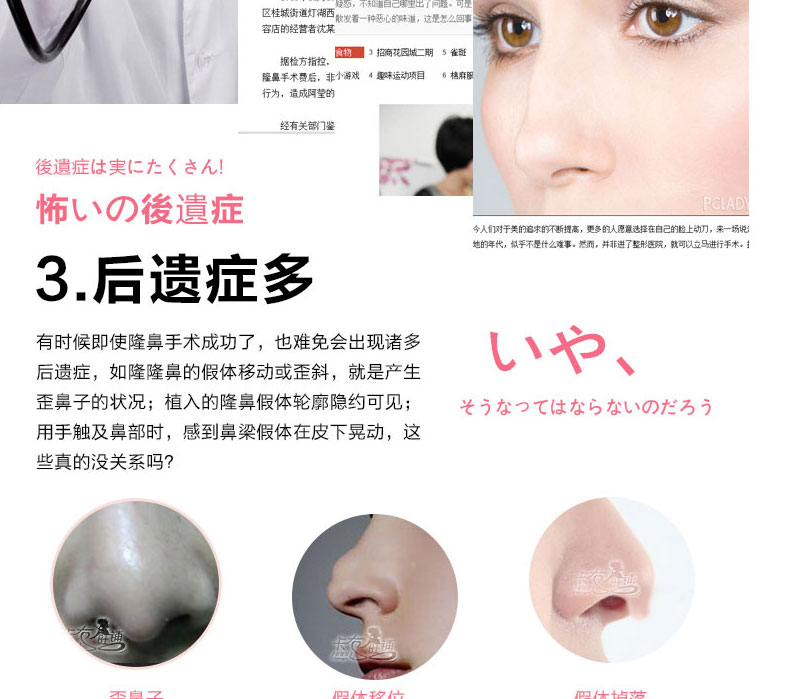 
                                                            瘦鼻美鼻四件套鼻梁增高器美鼻夹挺鼻器隆鼻器夹鼻子器鼻翼缩小大鼻头矫正整形 四件套                
