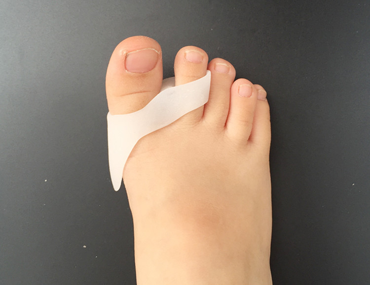 儿童拇外翻分趾器重叠指分离脚趾硅胶宝宝大母趾外翻纠正弯曲 小双环