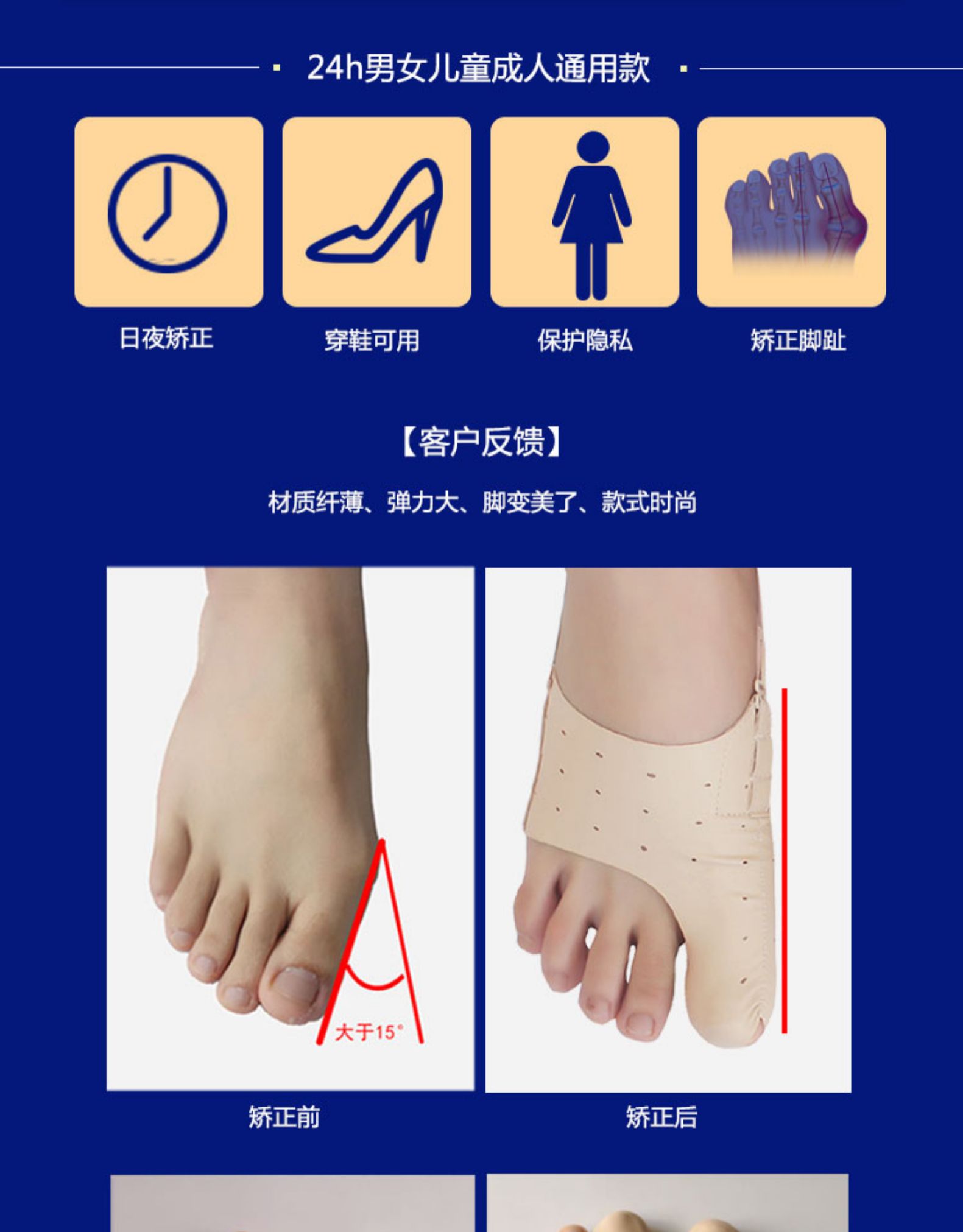 脚母子外翻矫正硅胶脚大拇指外翻矫正器成人大脚骨拇指外翻脚趾头姆