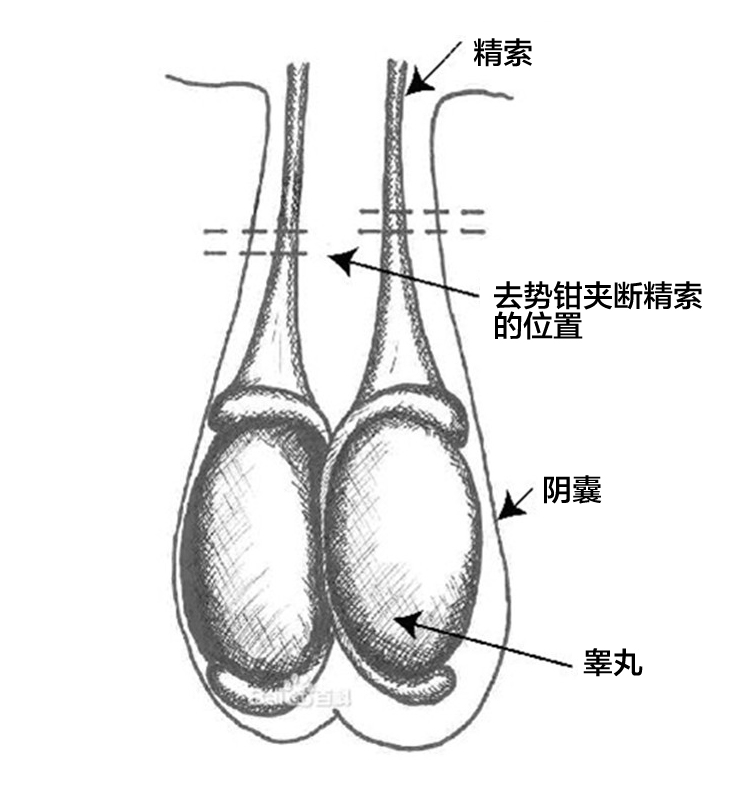 筷子无痛自阉法图片