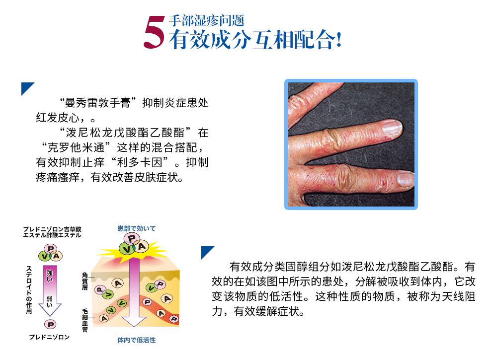 日本直邮乐敦曼秀雷敦手湿疹膏皮肤炎膏水虫脚气膏10 尿素足跟龟裂脱皮35g 图片价格品牌报价 京东