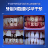 NHFOUYOU Japanese regenerated silicon toothpaste solidifies teeth, repairs gums, resists sensitivity, loosens plaque, prevents cavities, repairs enamel 120g
