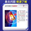 Rhinitis root medicine, special medicine for allergic rhinitis, sinusitis, itchy nose, runny nose, sneezing, ear, nose and throat medicine, oxymetazoline hydrochloride nasal drops (visual effects) 1 box, rhinitis, stuffy nose