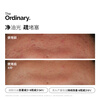 THE ORDINARY 10% Niacinamide + 1% Zinc 30ml Brightening, Oil Control, Pores Reduction, Acne Indica Amine Zinc Triple Control Essence New Year Gift