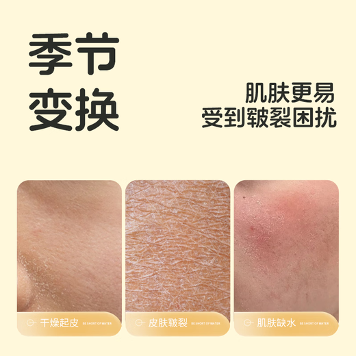 Sakose Vaseline Imported Horse Oil Cracked Stick 30g Repair Cream for Cracked Hands and Heels Moisturizing Soothing Hand Cream