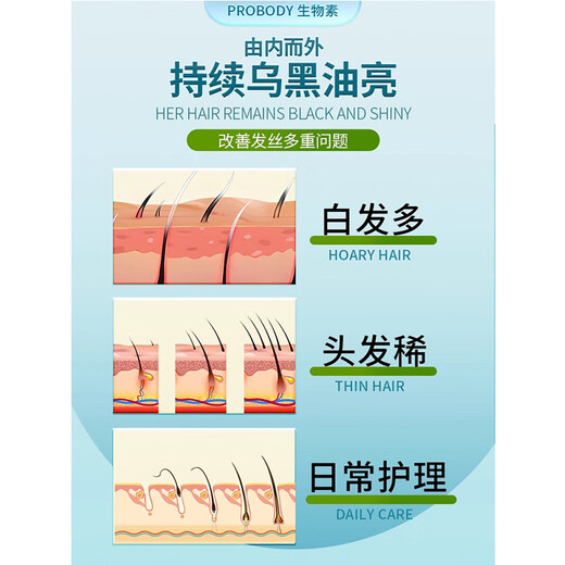 probodyPROBODY compound biotin tablets prevent loss I-fat-Pap Buddy men and women's vitamin B official flagship store SN695 1 bottle experience package