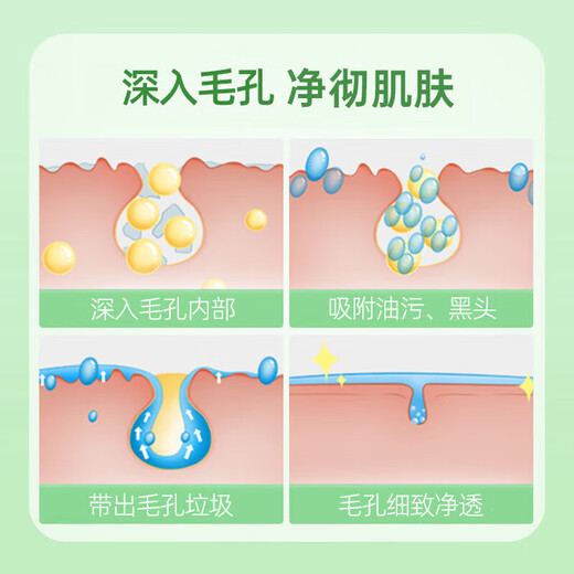 Renhe Ingenious Cleansing Mud Mask 100g Kaolin White Clay Oil Control Blackheads and Acne T Zone Moisturizing and Fine Pores Mask for Men and Women