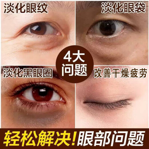 Nanjing Tongrentang snake venom eye cream for large eye bags and dark circles, fades fine lines and wrinkles, lifts and tightens, universal for men and women 50g