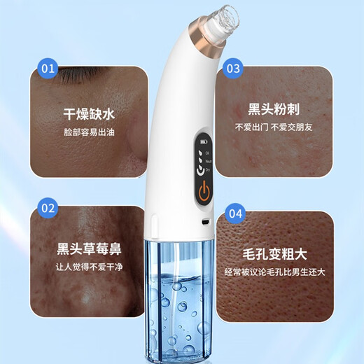 Mrs. Sakaguchi Blackhead Instrument Blackhead Cleaning Artifact for Men and Women Special for Cleaning Pores and Mildly Removing Acne Beauty Instrument Elegant White Upgraded Model (Mild Water Absorption)