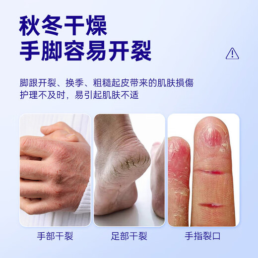 KOOGIS hand Vaseline dry crack patch, cracked finger patch, cracked crack protection non-medical genuine anti-crack tape