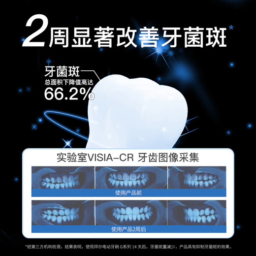 Bayer G1s flagship electric toothbrush adult charging smart sonic soft hair couple set automatic men and women gift to friends and students gift box