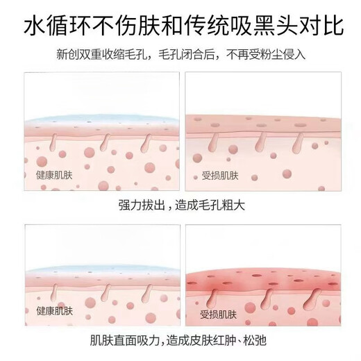 Lirenbang Small Bubble Beauty Instrument Facial Blackhead Absorbing Instrument Deep Pore Cleansing Instrument Hydrating Instrument Home Facial Electric Blackhead Remover and Acne Magic Instrument Blackhead Remover Basic Edition 8th Generation - Single Head Model (Blackhead Absorber) Photo Reward