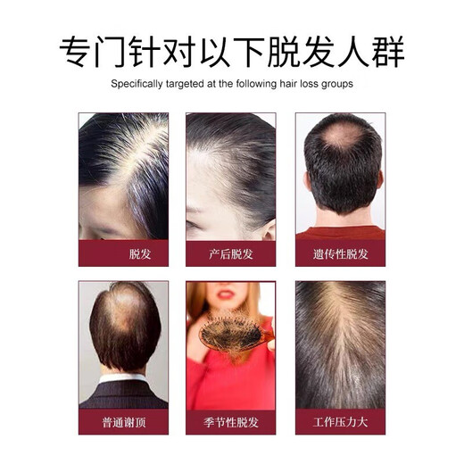 南京同仁堂生姜洗发水防脱育发洗发水脱发固发控油草本老姜王400ml*1+泵头*1