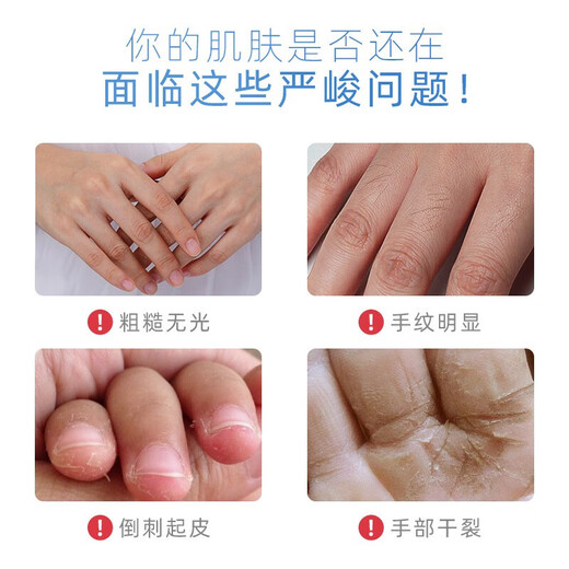 Sakose Vaseline tender smooth moisturizing hand mask 3 pairs hand cream moisturizing and diluting fine lines repairing hand care white gloves