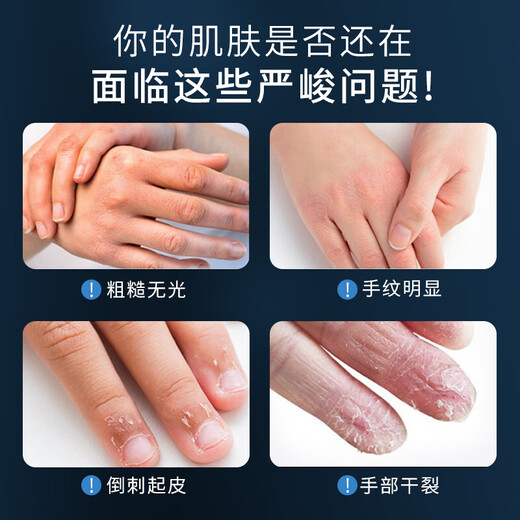 Sakose Vaseline Niacinamide Men's Special Hand Cream 2 bottles to prevent dryness and moisturize as a birthday gift gift box for boys