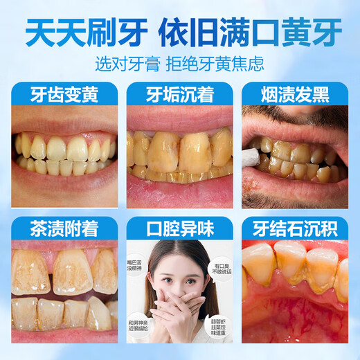 同仁堂美白牙膏金榜第一强力去黄牙结石口臭牙渍烟渍牙垢清新国货 1支装(100g)