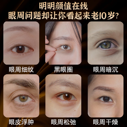 Nanjing Tongrentang Eye Cream Fades Lignes Rouges Le soulève se resserre les cercles noirs et les femmes sévères sacs pour les yeux éliminent anti-rides hydratantes de trois bouteilles [Deux bouteilles sauf 78]
