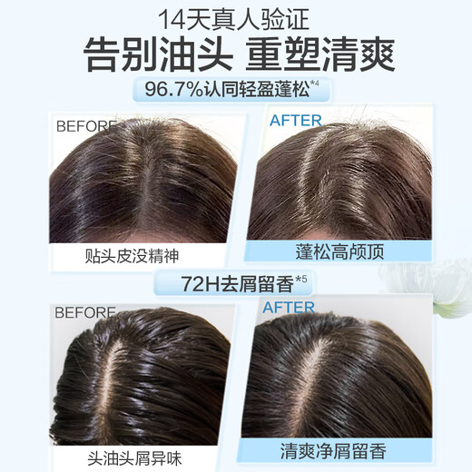 阿道夫洗发水沐浴露套装 香氛洗发露祛屑蓬松控油舒缓留香洗头膏 男女士 祛屑蓬松洗发水518ml*2瓶