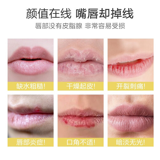 sakose Vaseline Chamomile Lip Balm 2.8g Four Seasons Anti-Crack Lip Mask Moisturizing Soothing and Repairing Lips Men and Women