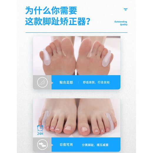 Bego Thumb Plalvular коррекционное устройство для взрослых детей, перекрывающихся носки для взрослых дежнедоровочных ног.