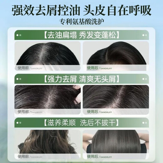 Halbgeschoss Blütenfeld Shampoo Duftkontrolle Ölkontrolle Flauschiger erfrischender Anti-Dandruff-weicher und juckender dauerhafter Duft neue und alte Verpackungen zufällig versandt, erfrischend Anti-TandRuff 750g