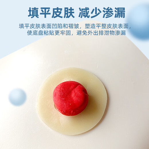 
Jafkari stoma leak-proof ring 7031 2mm ostomy pocket plastic leak-proof patch ring stoma chassis leak-proof stoma care