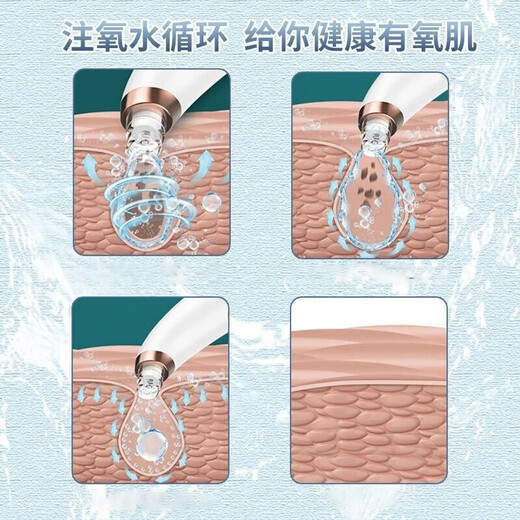 Mrs. Sakaguchi Blackhead Instrument Blackhead Cleaning Artifact for Men and Women Special for Cleaning Pores and Mildly Removing Acne Beauty Instrument Elegant White Upgraded Model (Mild Water Absorption)