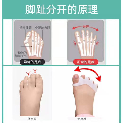 Baby and Children's Big Foot Toe Valgus et Backle Toe Correction Dispositif pour les enfants Toe à orteil curvé Splitter Yunan Yunfang Pharmacie Pharmacie (826) 1 à 8 ans White Five-Finger Toe Splitter / Deux paires les deux tailles