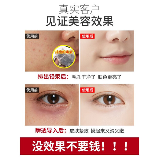 VLVEE Ultrasonic Beauty Instrument Export and Import Instrument Beauty Salon Special Instrument Facial Lifting Firming Facial Massage Oxygen Injection Hydration Instrument Pore Cleaning Home Elegant White/Beauty Salon High Style Storage Bracket + Skin Clearing Capsule + Gel