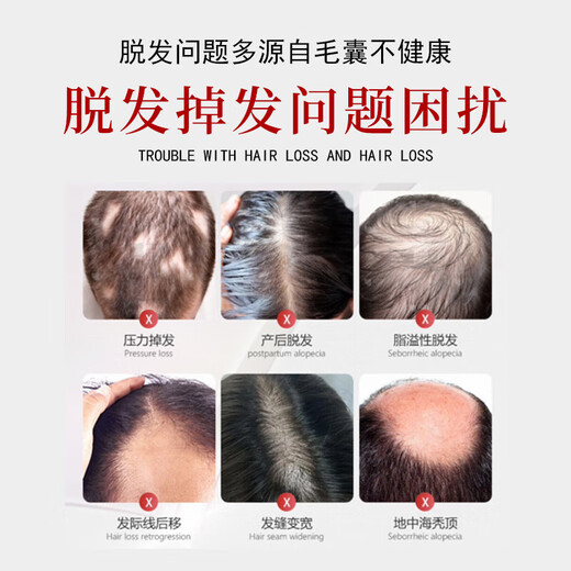 Dago Turkish Cypress Shampoo Пушистый и сильный контроль корня для волос и анти-перенос 8 раз бутылки против потери 300 мл*2