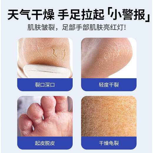 KOOGIS Japan Ding Ding Cracked Heel Anti-Dry Cracked Cracked Cracked Cracked Cream Heel Protective Moisturizer for Hands and Feet Cracked