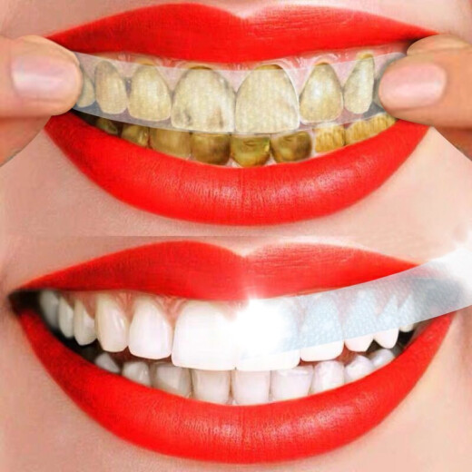 Beautiful eyes, bright white teeth, beautiful teeth, whitening, removing yellow teeth, smoke stains, tooth stains, dazzling white teeth, 4D dazzling white teeth, 7 pairs/14 pieces [Trial Pack] 1 box