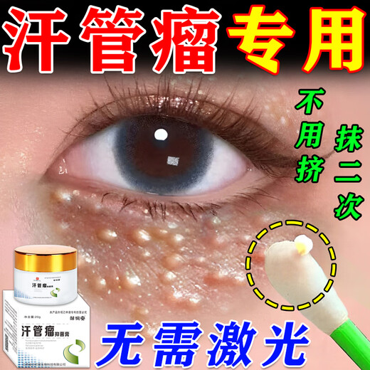 Syringoma eye removal artifact eye cream fat particles white particles oil particles unisex antibacterial cream 8 boxes buy 5 get 3 free