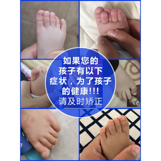 [JD Health] Kinderzehen, Kinderzehen, Big Thumb Valgus, Baby überlappendem Trennzeichen, Splitzes, Mutter nach innen abwärts 821+Food+Medium (2-9 Jahre) Durchschnittliche Größe 829 Kinder 5-Toe-Überlappung bequemer Stil 6-12 Jahre altes blaues ein Paarpaket