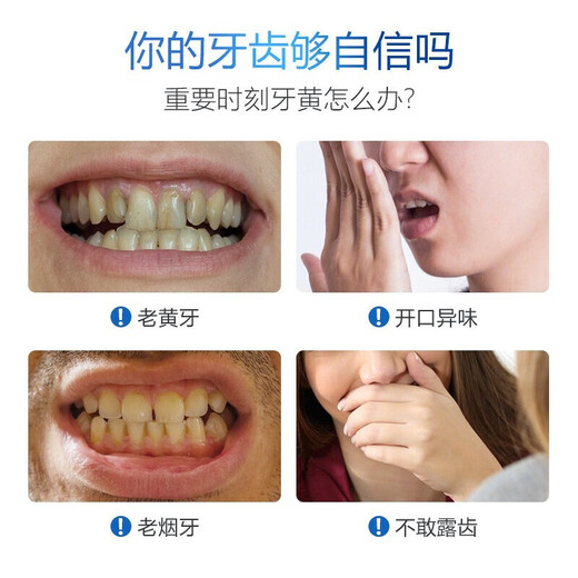 SMILEKIT white teeth strips for beautiful teeth, yellow teeth, whitening, reducing stains, cleaning teeth, whitening teeth, beautiful sparkling clean teeth, dental strips for men and women, 7 pairs, 1 box, 14 stickers in total [Trial Pack]