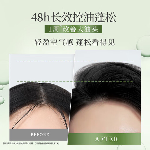 滋源无患子控油轻盈洗头水无硅蓬松男女士洗发露200ml