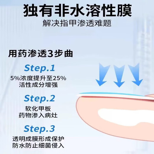 老徐字号阿莫罗芬灰指甲擦剂脱甲液增厚深层渗透修护甲板抑箘搽剂SN9866 5盒(买3囎2)[巩固装]