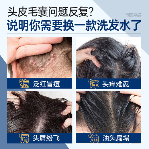 RUYI mite-removing and itching shampoo 500g Mao Yanning silicone-free oil control anti-dandruff seborrheic hair follicle scalp cleaning