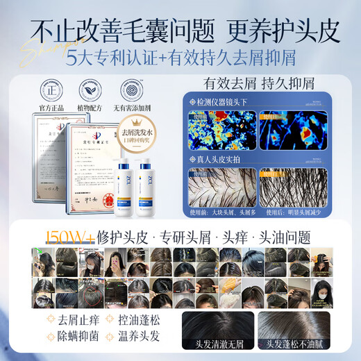 Shampooing zcl Sélénium disulfure anti-phase anti-ithit