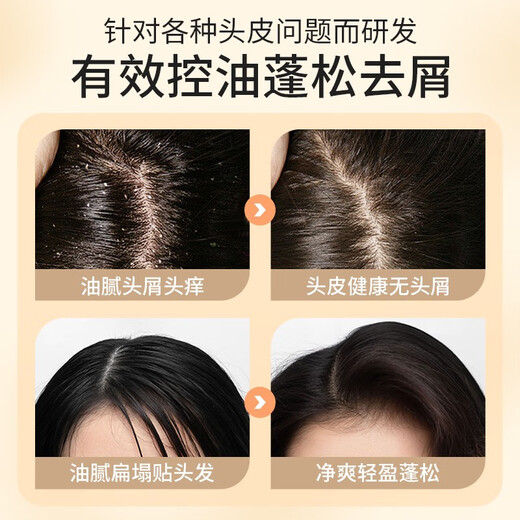 Aier Rice Water Shampoo Pflegendes, feuchtigkeitsspendendes, Anti-Schuppen- und reparierendes Duftshampoo 738 ml Taomi Water Feuchtigkeitsspendendes, nährendes und reparierendes Shampoo 738 ml