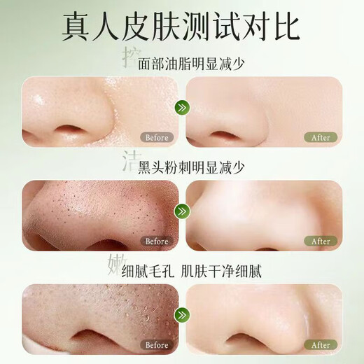 Island Diary Facial Cleanser Vitamin B7 Amino Acid Cleansing Mud Blackheads, Acne, Oil Control, Pore Shrinking, Men and Women 1 Bottle, Effective Cleansing