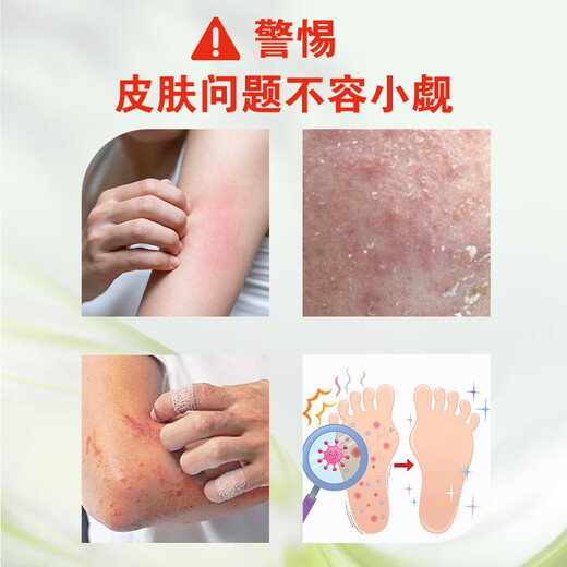 Changhao Shennong Baicao Cream Official Wet Itching Skin Care Tianjin Shenlong Herbal Cream Moisturizing Box of 2 Bottles