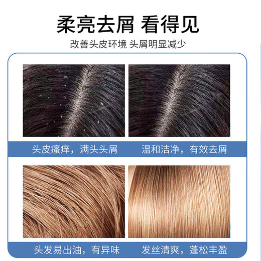 Hair 100 ans Hydrating Shampooing Anti-Dandruff Anti-ICM Amino Acid Shampooing Head Cream Shampooin