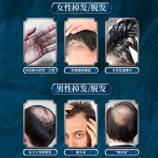 南京同仁堂生姜洗发水防脱育发洗发水脱发固发控油草本老姜王400ml*1+泵头*1