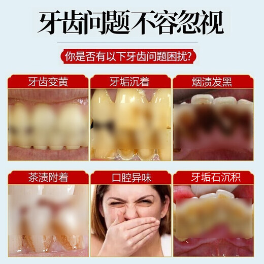 Yunnan Materia Medica Zahnreinigung Pulver frischer Atem Entfernen gelbe Zähne Entfernen Sie Zähne